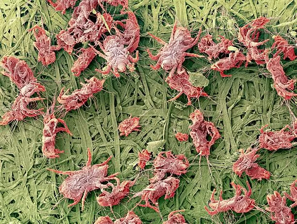 Dust Mites in Bed Symptoms